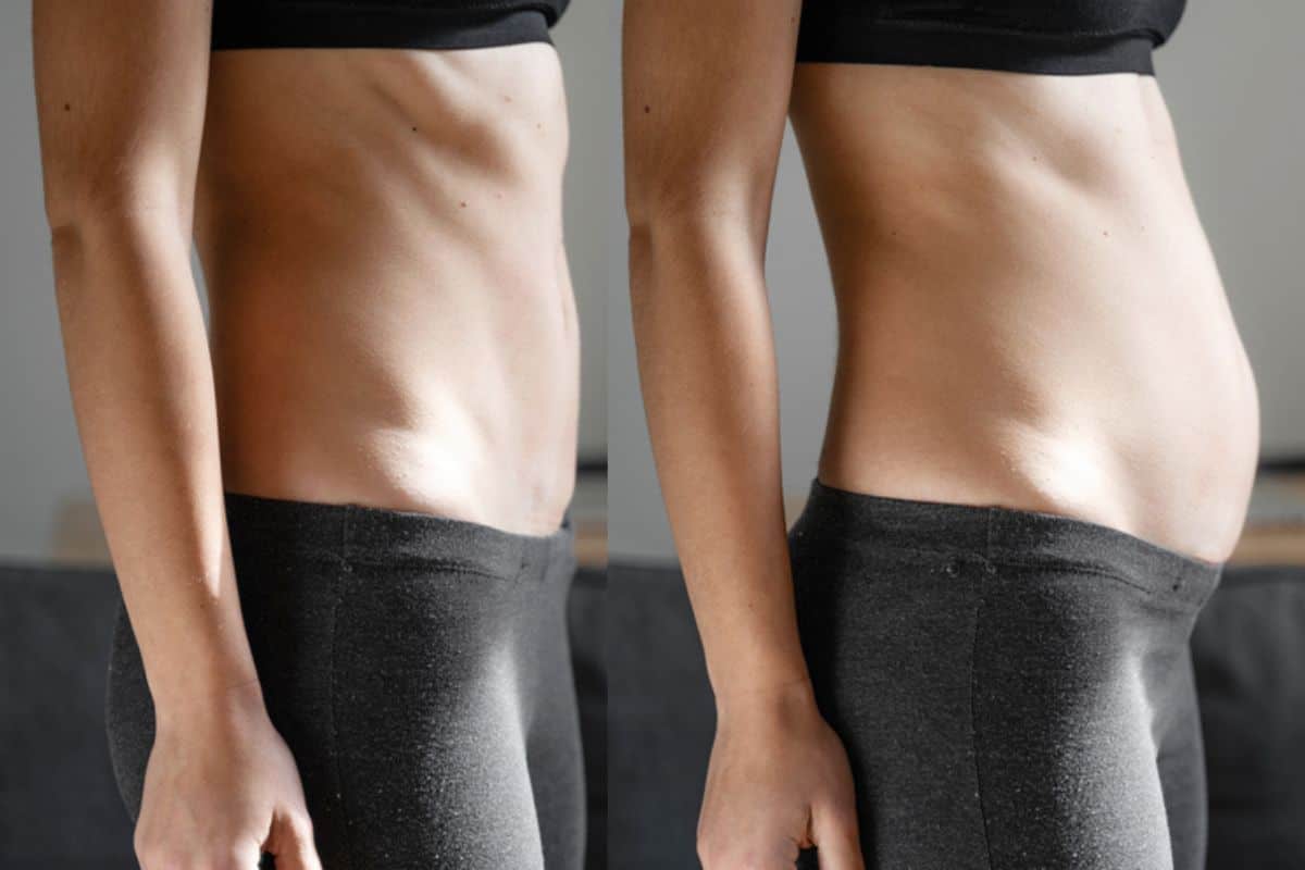 How long does diastasis recti take to improve Brighton and Hove?