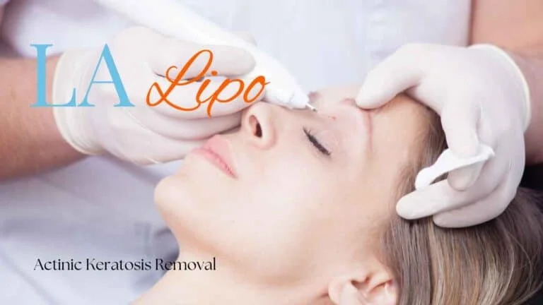 Woman receiving Actinic Keratosis Removal Treatment Brighton and Hove