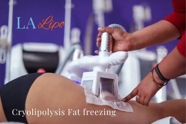 women getting fat freezing Brighton and Hove