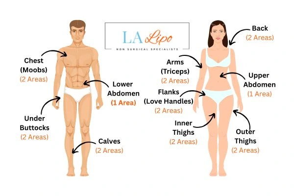 LA LIPO Cryolipolysis Areas Brighton and Hove