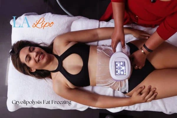woman getting cryolipolysis Brighton and Hove