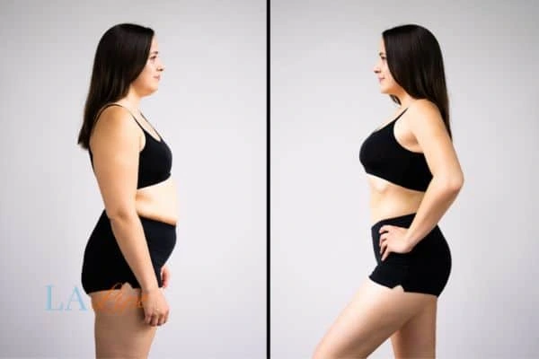 Picture of womans before and after using LA-EMS body sculpting to improve her core strength Brighton and Hove