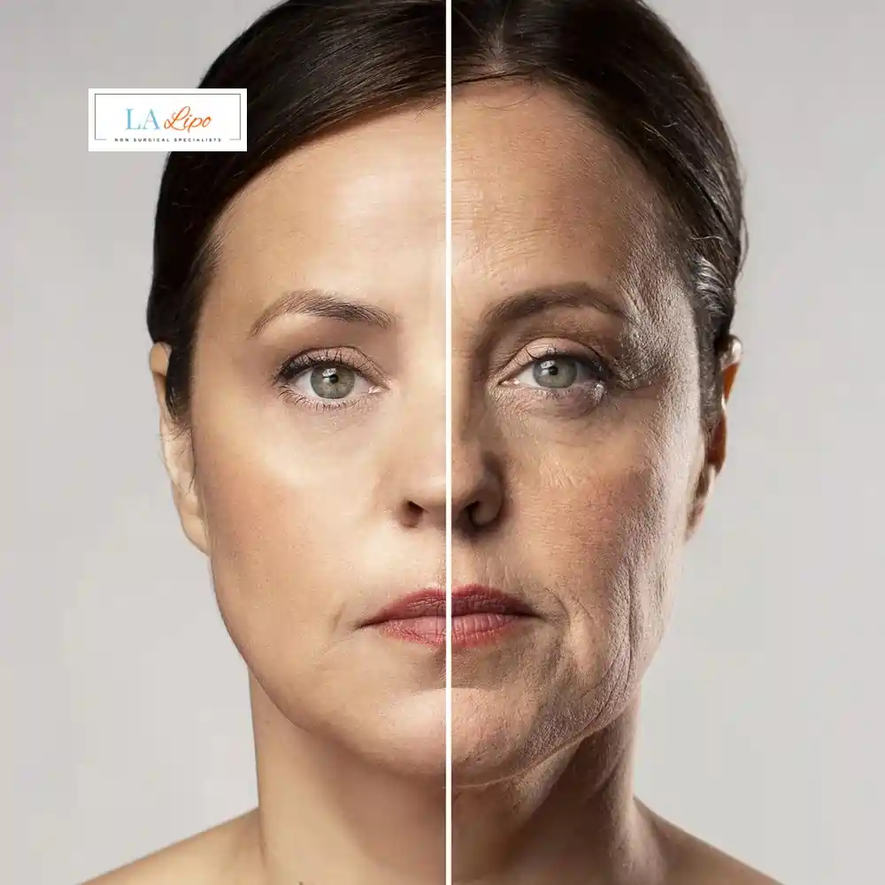 How Can You Tell If Non-Surgical Skin Tightening Is Right for You Brighton and Hove?