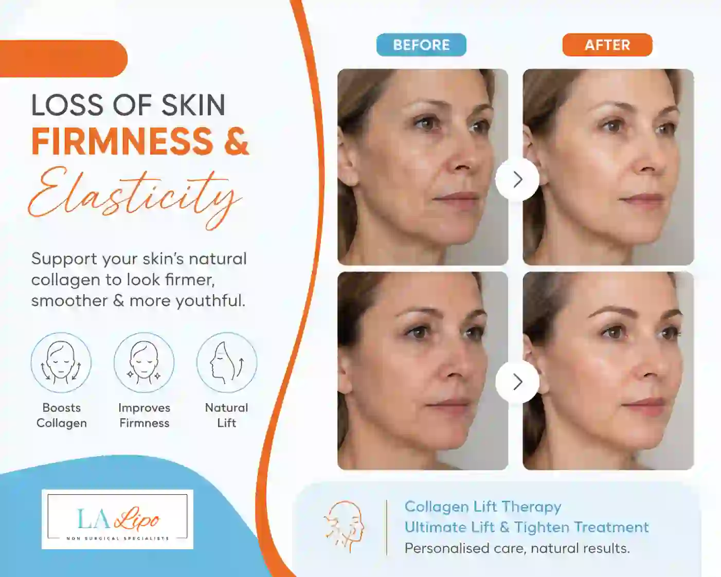 Sign #7: Loss of Skin Firmness and Elasticity Brighton and Hove